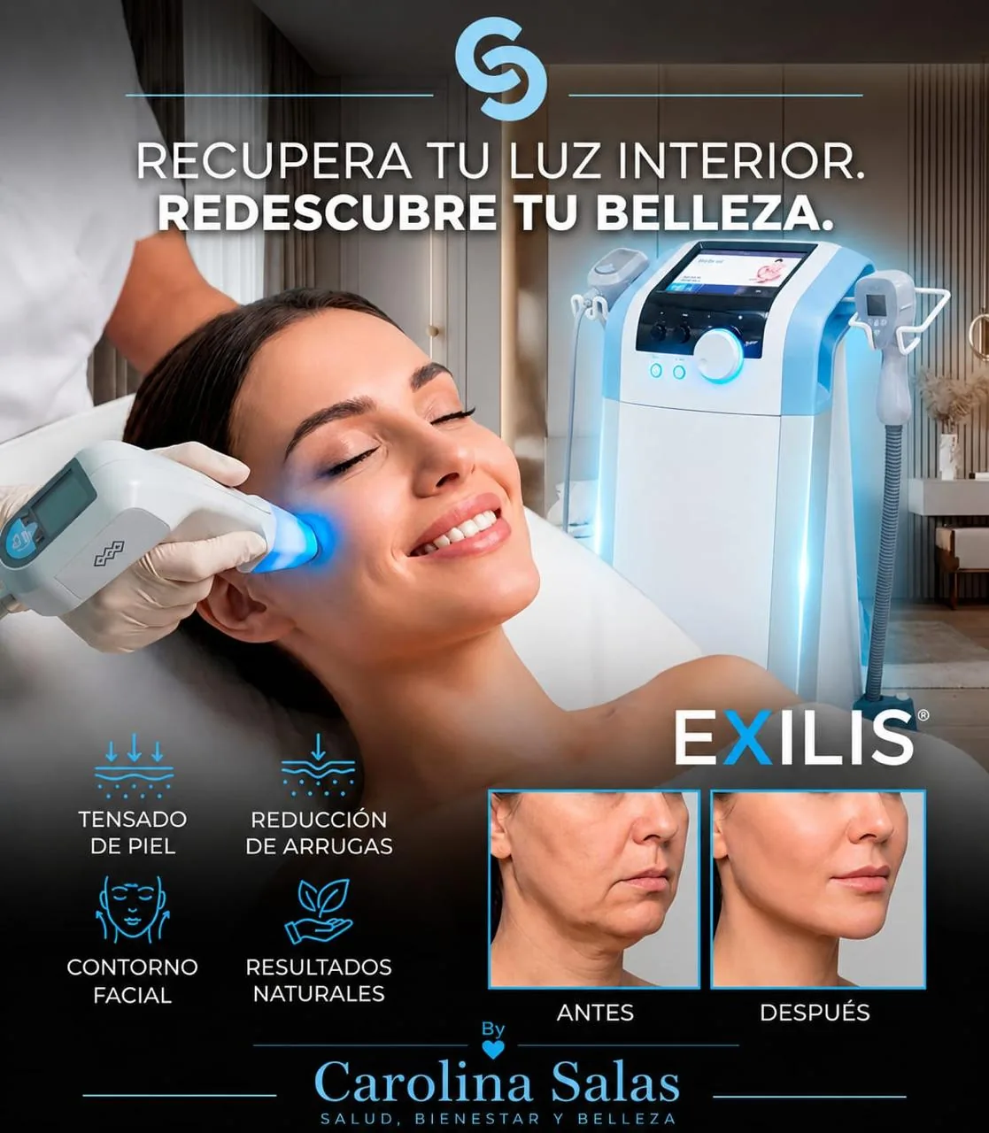 Exilis Ultra 360 para rejuvenecimiento y tensado de la piel en Bogotá