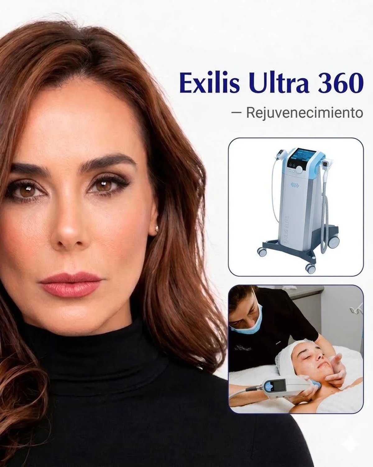 Exilis Ultra 360, rejuvenecimiento facial y corporal con radiofrecuencia y ultrasonido en Bogotá