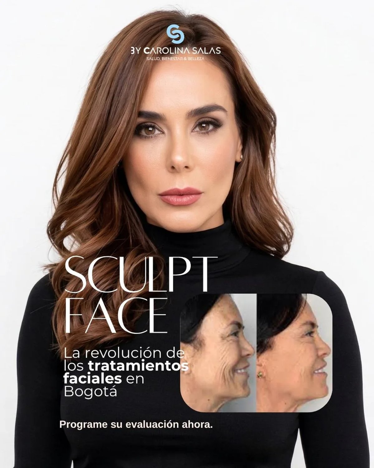 Sculpt Face, lifting y rejuvenecimiento facial no invasivo sin cirugía en Bogotá