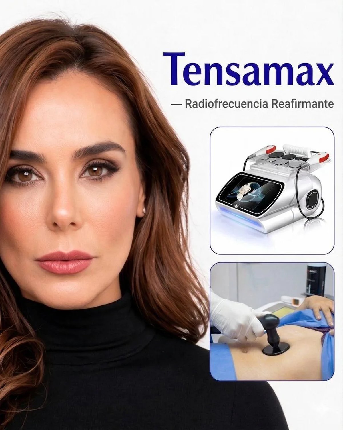 Tratamiento Tensamax de radiofrecuencia reafirmante para piel y contornos en Bogotá